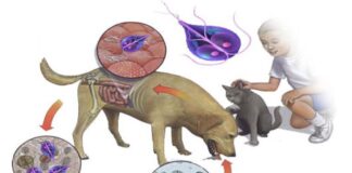 Эхинококкоз? Боже, упаси!