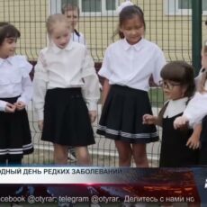 Ахондроплазия — не болезнь, а особенность Ахондроплазия — не болезнь, а особенность