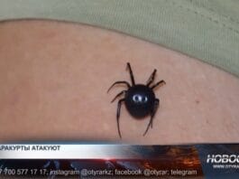 Укус каракурта