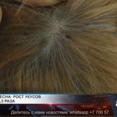 Зараженных ККГЛ клещей выявили в Шымкенте Зараженных ККГЛ клещей выявили в Шымкенте