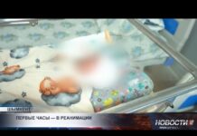 Младенец перенёс две операции в первые часы жизни