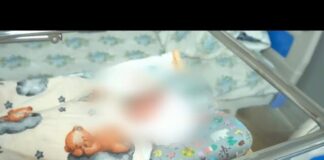 Младенец перенёс две операции в первые часы жизни