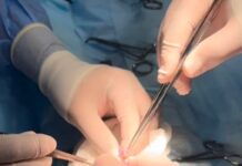 В Шымкенте трёхлетний ребёнок проглотил 16 магнитов