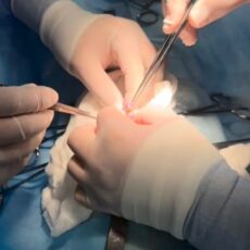 В Шымкенте трёхлетний ребёнок проглотил 16 магнитов