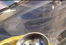 Почти 1 кг волос нашли в желудке у подростка в Туркестанской области