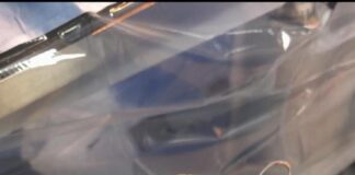 Почти 1 кг волос нашли в желудке у подростка в Туркестанской области