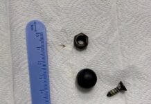 Врачи извлекли магнит и металлические предметы из кишечника ребенка