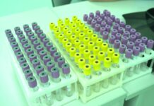 Около 18 тысяч казахстанцев стали донорами в рамках февральской акции