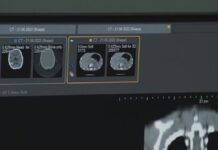 ИИ помогает врачам Казахстана быстрее выявлять инсульт и онкологию