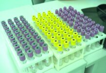 Более 12 тысяч казахстанцев согласились на посмертное донорство