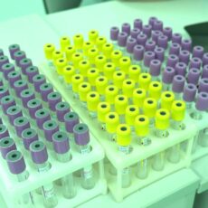 Более 12 тысяч казахстанцев согласились на посмертное донорство