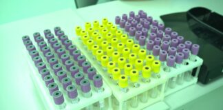 Более 12 тысяч казахстанцев согласились на посмертное донорство