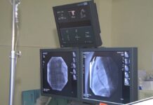 В Шымкенте успешно провели сложную операцию пациенту, потерявшему способность ходить