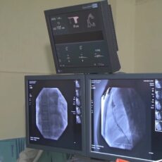 В Шымкенте успешно провели сложную операцию пациенту, потерявшему способность ходить
