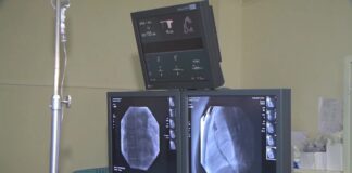 В Шымкенте успешно провели сложную операцию пациенту, потерявшему способность ходить