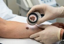 День открытых дверей для ранней диагностики онкозаболеваний пройдет в Шымкенте