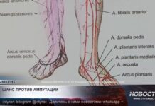 Шанс против ампутации