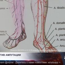 Шанс против ампутации