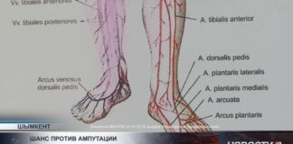 Шанс против ампутации