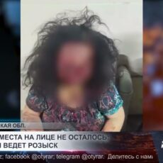 Живого места на лице не осталось: полиция ведет розыск