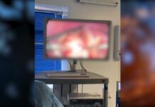 В Шымкенте хирурги провели малоинвазивную операцию пациенту с эхинококкозом